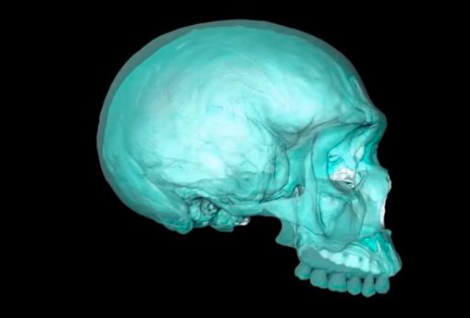 Científicos reconstruyen virtualmente el cráneo del ancestro del Homo Sapiens