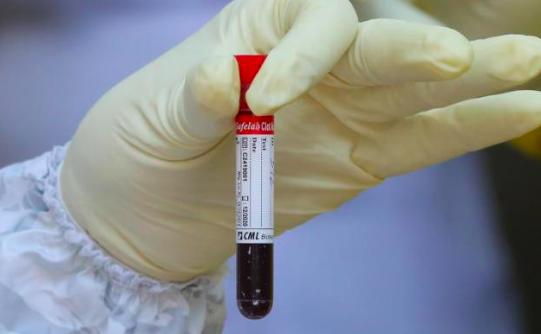 Sangre tipo O podría ofrecer cierta protección contra la infección por COVID-19