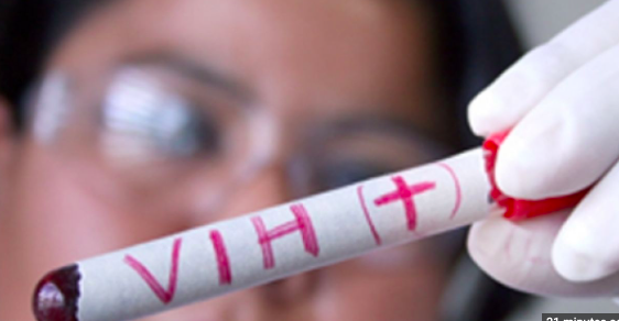 OMS alerta de subida de casos de VIH en Europa y de deficiencias en test