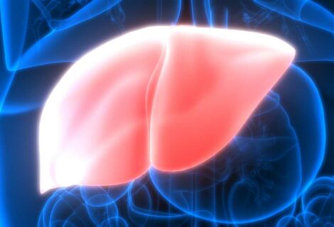 Hígado graso: la infusión natural que ayuda a combatirlo