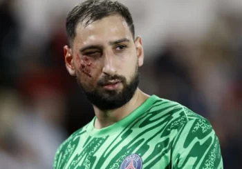 Donnarumma sufre un traumatismo facial con "múltiples heridas" y está pendiente de pruebas